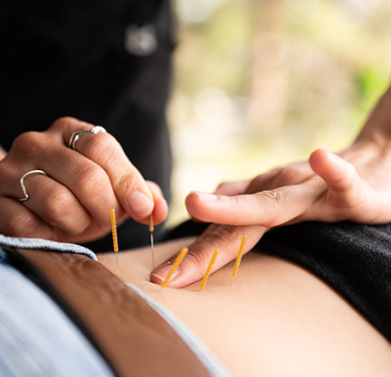 Advanced Dry Needling